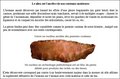 couteaux (3)